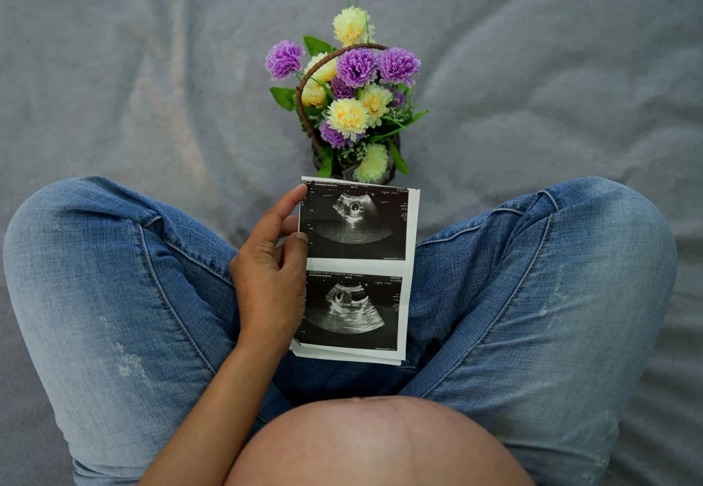 Première échographie de grossesse : la sonde posée sur le ventre d'une future maman pendant l'examen du premier trimestre